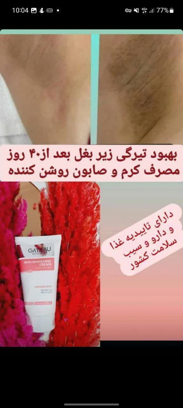 کرم روشن کننده بدن گاتیو ویژگیهای محصول🔻🔻 برند: گاتیو اندازه: 150 میل •روشن کردن پوست و متعادل سازی رنگ آن •از بین بردن لکه های تیره روی پوست •رطوبت رسانی فوق العاده به پوست •جلوگیری از ایجاد لکه های پوستی ناشی از افزایش سن •تقویت کردن پوست 🔴