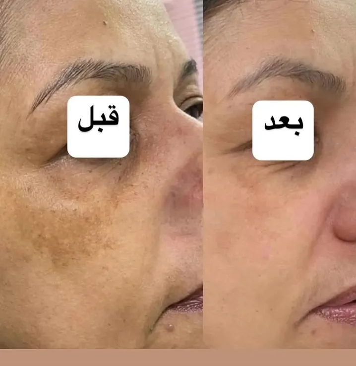 کرم ویتابلا60میل و صابون بیز
